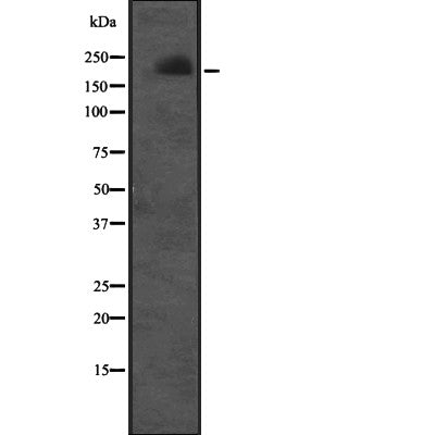 Western blot analysis of CUL7 expression in  Molt-4 cell lysate ;,The lane on the left is treated with the antigen-specific peptide.