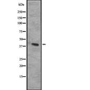 Western blot analysis of CXCR3 expression in  Hela cell lysate,The lane on the left is treated with the antigen-specific peptide.