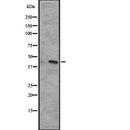 Western blot analysis of extracts from RAW264.7, using CXCR5 Antibody. The lane on the left was treated with blocking peptide.