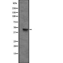 Western blot analysis of CXCR6 expression in HEK293 cells ,The lane on the left is treated with the antigen-specific peptide.