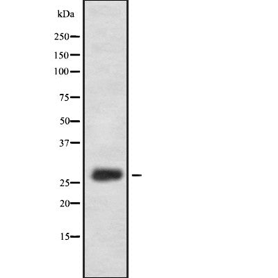 Western blot analysis of extracts from Mouse brain, using FA58A Antibody. The lane on the left was treated with blocking peptide.