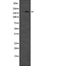 Western blot analysis of JIP4 expression in  Hela cell lysate,The lane on the left is treated with the antigen-specific peptide.