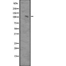 DF2335 at 1/100 staining Human liver tissue by IHC-P. The sample was formaldehyde fixed and a heat mediated antigen retrieval step in citrate buffer was performed. The sample was then blocked and incubated with the antibody for 1.5 hours at 22¡ãC. An HRP conjugated goat anti-rabbit antibody was used as the secondary