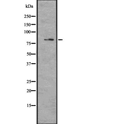 DF2351 at 1/100 staining Human spleen tissue by IHC-P. The sample was formaldehyde fixed and a heat mediated antigen retrieval step in citrate buffer was performed. The sample was then blocked and incubated with the antibody for 1.5 hours at 22¡ãC. An HRP conjugated goat anti-rabbit antibody was used as the secondary