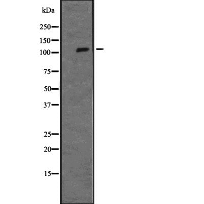 Western blot analysis of MAPK7 expression in  Hela cell lysate,The lane on the left is treated with the antigen-specific peptide.