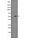 DF2357 staining  A549 cells by IF/ICC. The sample were fixed with PFA and permeabilized in 0.1% Triton X-100,then blocked in 10% serum for 45 minutes at 25¡ãC. The primary antibody was diluted at 1/200 and incubated with the sample for 1 hour at 37¡ãC. An  Alexa Fluor 594 conjugated goat anti-rabbit IgG (H+L) antibody(Cat.