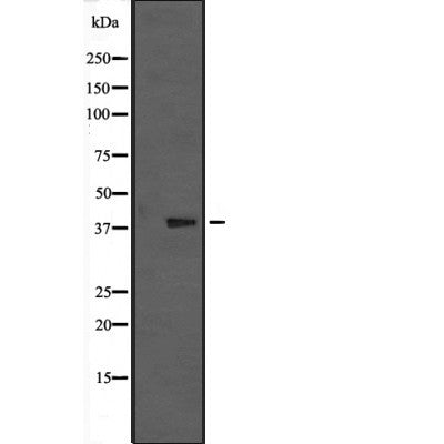 Western blot analysis of MAPK13 expression in  nocodazole treated HCT116 cell lysate; PMA-treated Pam212 cell lysate,The lane on the left is treated with the antigen-specific peptide.
