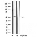 Western blot analysis of MKNK2 expression in A431 whole cell lysate ,The lane on the left is treated with the antigen-specific peptide.