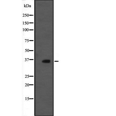 Western blot analysis of MORG1 expression in  rat brain tissue lysate;,The lane on the left is treated with the antigen-specific peptide.