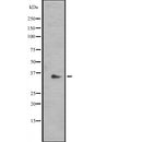 Western blot analysis of RAD1 expression in  Hela cell lysate,The lane on the left is treated with the antigen-specific peptide.