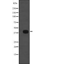 DF2365 at 1/100 staining Mouse kidney tissue by IHC-P. The sample was formaldehyde fixed and a heat mediated antigen retrieval step in citrate buffer was performed. The sample was then blocked and incubated with the antibody for 1.5 hours at 22¡ãC. An HRP conjugated goat anti-rabbit antibody was used as the secondary