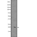 DF2366 at 1/100 staining Mouse testis tissue by IHC-P. The sample was formaldehyde fixed and a heat mediated antigen retrieval step in citrate buffer was performed. The sample was then blocked and incubated with the antibody for 1.5 hours at 22¡ãC. An HRP conjugated goat anti-rabbit antibody was used as the secondary
