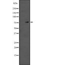 Western blot analysis of TAB2 expression in HEK293 cells ,The lane on the left is treated with the antigen-specific peptide.