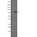 Western blot analysis of TAB3 expression in  Hela cell lysate,The lane on the left is treated with the antigen-specific peptide.
