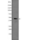 DF2372 at 1/100 staining Human gastric tissue by IHC-P. The sample was formaldehyde fixed and a heat mediated antigen retrieval step in citrate buffer was performed. The sample was then blocked and incubated with the antibody for 1.5 hours at 22¡ãC. An HRP conjugated goat anti-rabbit antibody was used as the secondary
