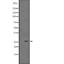 Western blot analysis of GADD45A expression in A431 whole cell lysate ,The lane on the left is treated with the antigen-specific peptide.