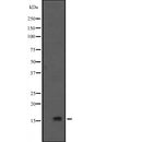 Western blot analysis of GADD45G expression in HEK293 cells ,The lane on the left is treated with the antigen-specific peptide.