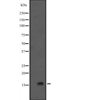 Western blot analysis of GADD45G expression in HEK293 cells ,The lane on the left is treated with the antigen-specific peptide.