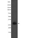 DF2378 at 1/100 staining Human Melanoma tissue by IHC-P. The sample was formaldehyde fixed and a heat mediated antigen retrieval step in citrate buffer was performed. The sample was then blocked and incubated with the antibody for 1.5 hours at 22¡ãC. An HRP conjugated goat anti-rabbit antibody was used as the secondary