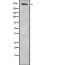 Western blot analysis of LAMA5 expression in HEK293 cells ,The lane on the left is treated with the antigen-specific peptide.
