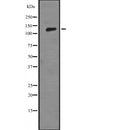 Western blot analysis of LAMB3 expression in HEK293 cells ,The lane on the left is treated with the antigen-specific peptide.