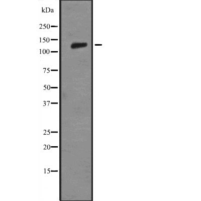Western blot analysis of LAMB3 expression in HEK293 cells ,The lane on the left is treated with the antigen-specific peptide.