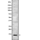 DF2383 staining  Hela cells by IF/ICC. The sample were fixed with PFA and permeabilized in 0.1% Triton X-100,then blocked in 10% serum for 45 minutes at 25¡ãC. The primary antibody was diluted at 1/200 and incubated with the sample for 1 hour at 37¡ãC. An  Alexa Fluor 594 conjugated goat anti-rabbit IgG (H+L) antibody(Cat.