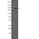 DF2385 staining HuvEc by IF/ICC. The sample were fixed with PFA and permeabilized in 0.1% Triton X-100,then blocked in 10% serum for 45 minutes at 25¡ãC. The primary antibody was diluted at 1/200 and incubated with the sample for 1 hour at 37¡ãC. An  Alexa Fluor 594 conjugated goat anti-rabbit IgG (H+L) Ab, diluted at 1/600, was used as the secondary antibod