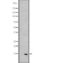 DF2387 staining  Hela cells by IF/ICC. The sample were fixed with PFA and permeabilized in 0.1% Triton X-100,then blocked in 10% serum for 45 minutes at 25¡ãC. The primary antibody was diluted at 1/200 and incubated with the sample for 1 hour at 37¡ãC. An  Alexa Fluor 594 conjugated goat anti-rabbit IgG (H+L) antibody(Cat.