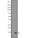Western blot analysis of PHLDA3 expression in HEK293 cells ,The lane on the left is treated with the antigen-specific peptide.