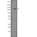 DF2391 staining  HeLa cells by IF/ICC. The sample were fixed with PFA and permeabilized in 0.1% Triton X-100,then blocked in 10% serum for 45 minutes at 25¡ãC. The primary antibody was diluted at 1/200 and incubated with the sample for 1 hour at 37¡ãC. An  Alexa Fluor 594 conjugated goat anti-rabbit IgG (H+L) antibody(Cat.