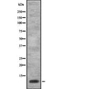 DF2394 at 1/100 staining Human uterus tissue by IHC-P. The sample was formaldehyde fixed and a heat mediated antigen retrieval step in citrate buffer was performed. The sample was then blocked and incubated with the antibody for 1.5 hours at 22¡ãC. An HRP conjugated goat anti-rabbit antibody was used as the secondary