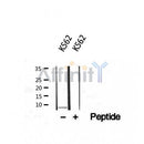Western blot analysis of extracts from K526, using CBF-C Antibody.