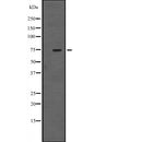 Western blot analysis of TBR1 expression in  Mouse Hippocampus Whole Cell Lysate,The lane on the left is treated with the antigen-specific peptide.