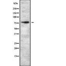 Western blot analysis of extracts from Mouse brain, using ZNF750 Antibody. The lane on the left was treated with blocking peptide.