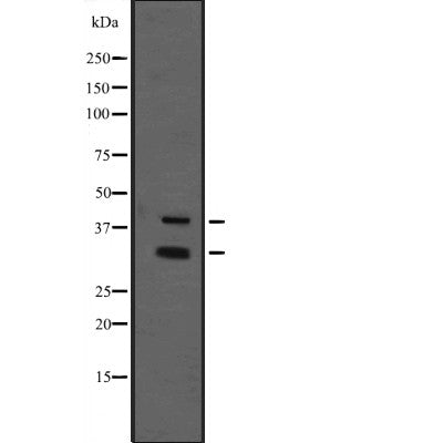 Western blot analysis of MIBP1 expression in  immunising recombinant protein,The lane on the left is treated with the antigen-specific peptide.