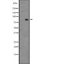 Western blot analysis of NR3C1 expression in Jurkat cell lysate,The lane on the left is treated with the antigen-specific peptide.