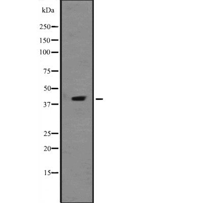 Western blot analysis of extracts from Mouse brain, using TIAL1 Antibody. The lane on the left was treated with blocking peptide.