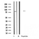 Western blot analysis of TB10B expression in HEK293 cells ,The lane on the left is treated with the antigen-specific peptide.