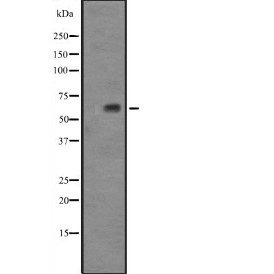 DF2402 staining HepG2 by IF/ICC. The sample were fixed with PFA and permeabilized in 0.1% Triton X-100,then blocked in 10% serum for 45 minutes at 25¡ãC. The primary antibody was diluted at 1/200 and incubated with the sample for 1 hour at 37¡ãC. An  Alexa Fluor 594 conjugated goat anti-rabbit IgG (H+L) Ab, diluted at 1/600, was used as the secondary antibod