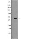 DF2403 at 1/100 staining Mouse testis tissue by IHC-P. The sample was formaldehyde fixed and a heat mediated antigen retrieval step in citrate buffer was performed. The sample was then blocked and incubated with the antibody for 1.5 hours at 22¡ãC. An HRP conjugated goat anti-rabbit antibody was used as the secondary