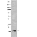 DF2404 at 1/100 staining Mouse lung tissue by IHC-P. The sample was formaldehyde fixed and a heat mediated antigen retrieval step in citrate buffer was performed. The sample was then blocked and incubated with the antibody for 1.5 hours at 22¡ãC. An HRP conjugated goat anti-rabbit antibody was used as the secondary