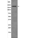 DF2405 at 1/100 staining Rat heart tissue by IHC-P. The sample was formaldehyde fixed and a heat mediated antigen retrieval step in citrate buffer was performed. The sample was then blocked and incubated with the antibody for 1.5 hours at 22¡ãC. An HRP conjugated goat anti-rabbit antibody was used as the secondary