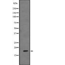 Western blot analysis of HES5 expression in  293 cell lysate ,The lane on the left is treated with the antigen-specific peptide.