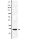 Western blot analysis of HES3 expression in HEK293 cells ,The lane on the left is treated with the antigen-specific peptide.