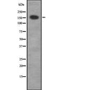 DF2413 at 1/100 staining Mouse muscle tissue by IHC-P. The sample was formaldehyde fixed and a heat mediated antigen retrieval step in citrate buffer was performed. The sample was then blocked and incubated with the antibody for 1.5 hours at 22¡ãC. An HRP conjugated goat anti-rabbit antibody was used as the secondary