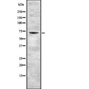 Western blot analysis of CRTC2 expression in HEK293 cells ,The lane on the left is treated with the antigen-specific peptide.
