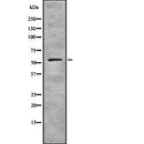 Western blot analysis of extracts from B16F10, using ZNF497 Antibody. The lane on the left was treated with blocking peptide.