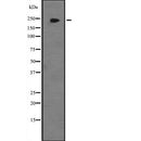Western blot analysis of JMJD1B expression in  Hela cell lysate,The lane on the left is treated with the antigen-specific peptide.