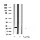 Western blot analysis of  expression in HEK293 cells ,The lane on the left is treated with the antigen-specific peptide.